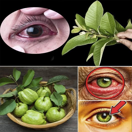 Hojas de guayaba para salud ocular