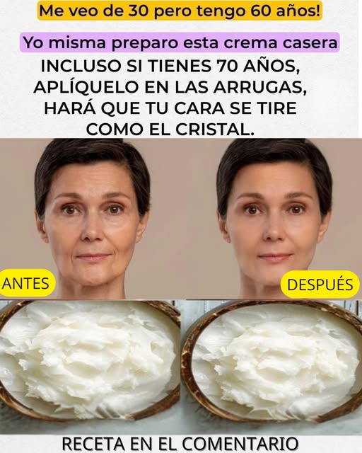 Crema casera de bicarbonato
