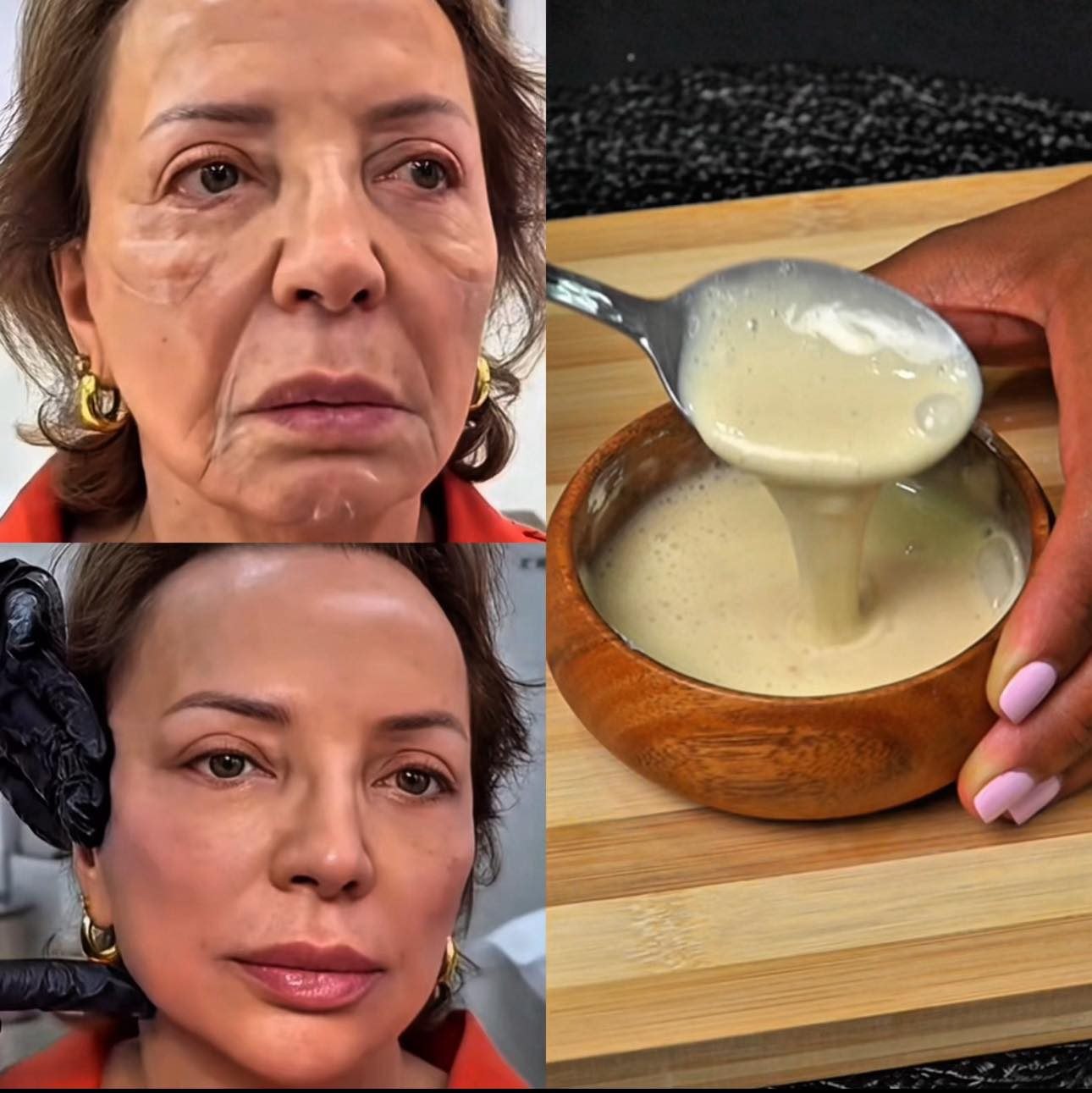Proceso de tratamiento facial estético