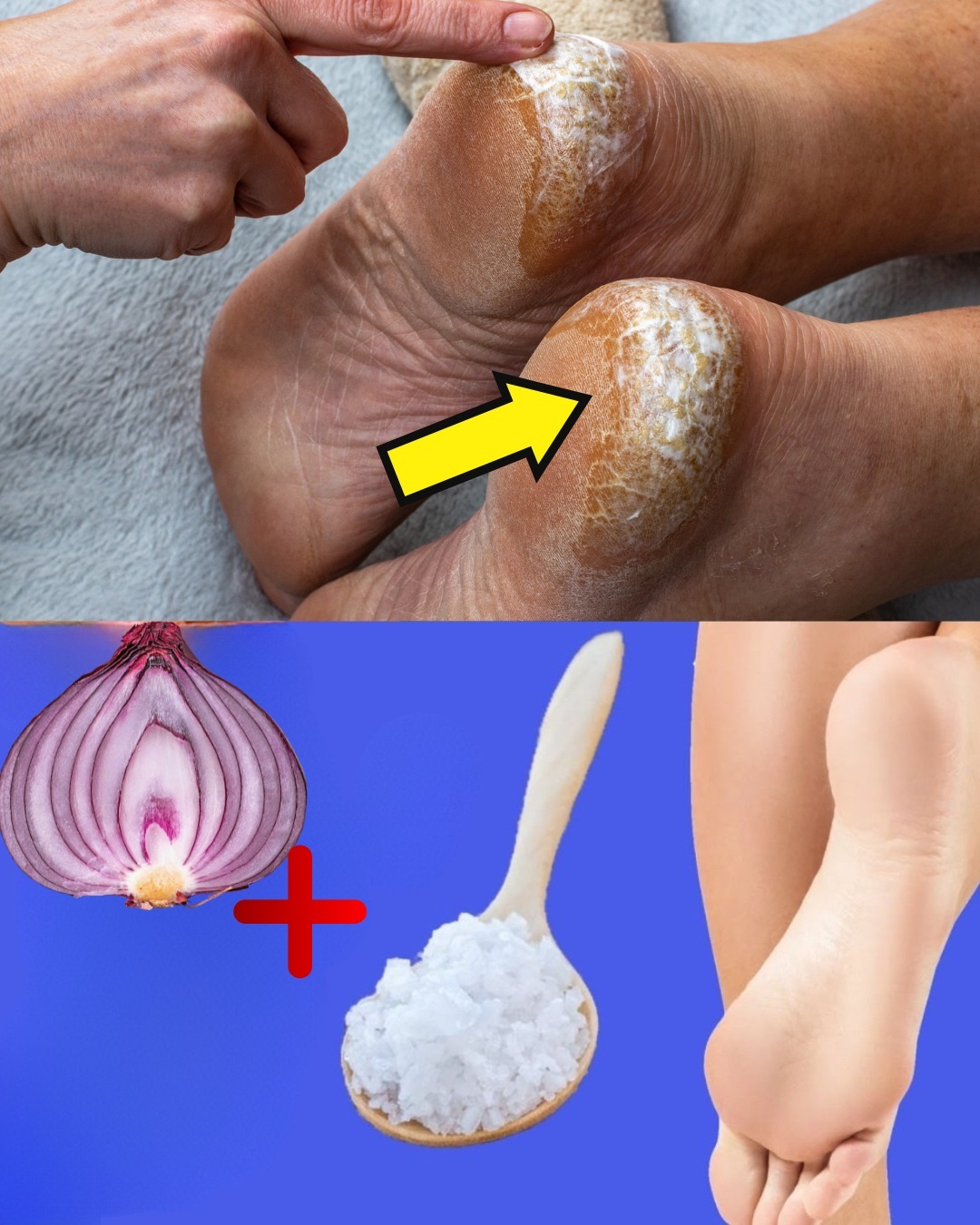 Remedio natural para talones agrietados