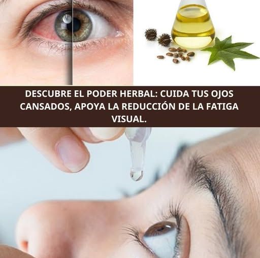 Mejora de Salud Ocular con Remedios Naturales