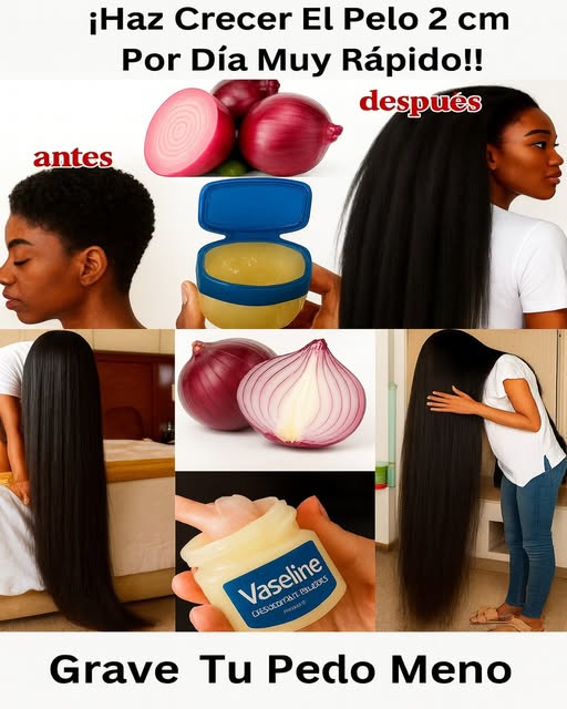 Antes y Después de usar cebolla y vaselina para el crecimiento del cabello