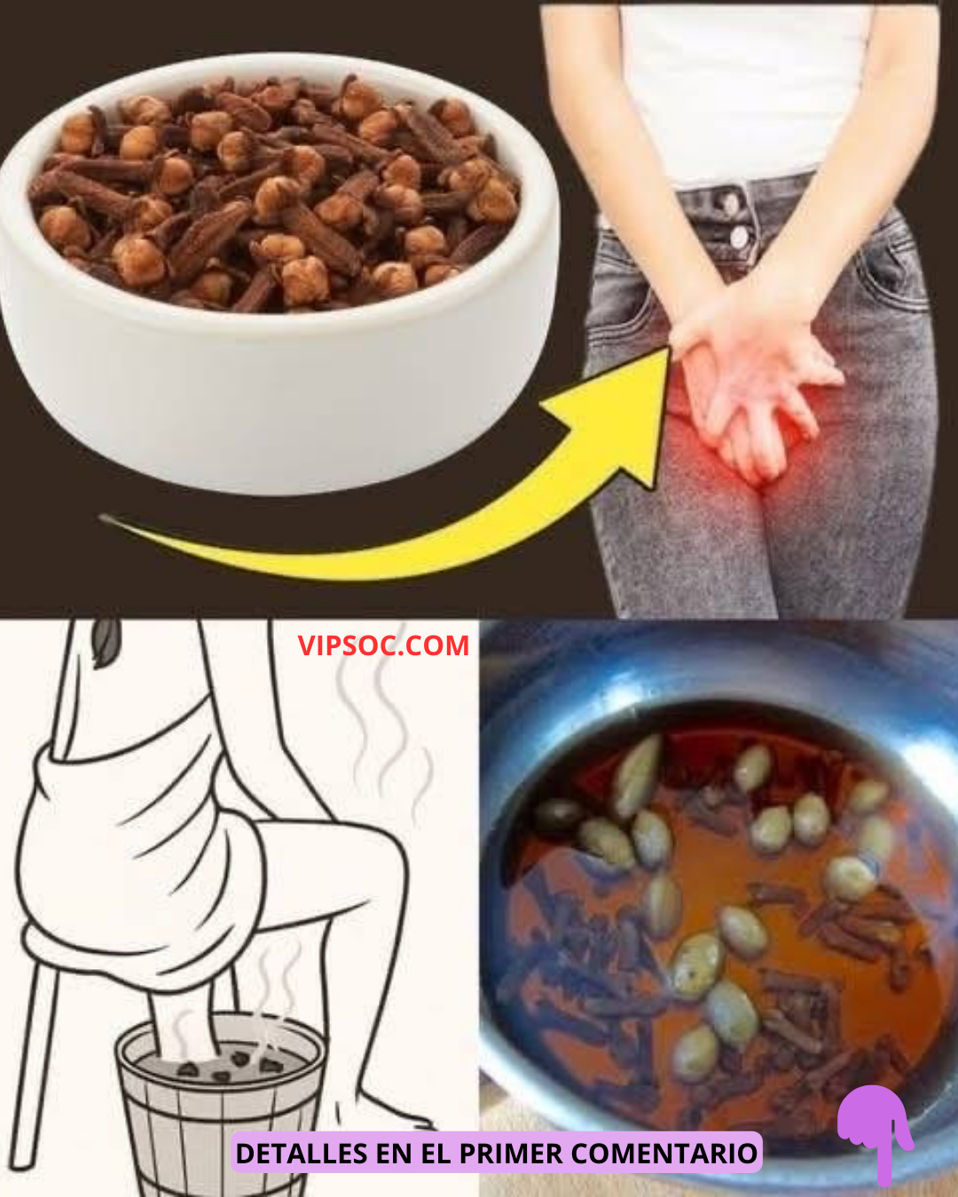 Baño de vapor con clavos de olor