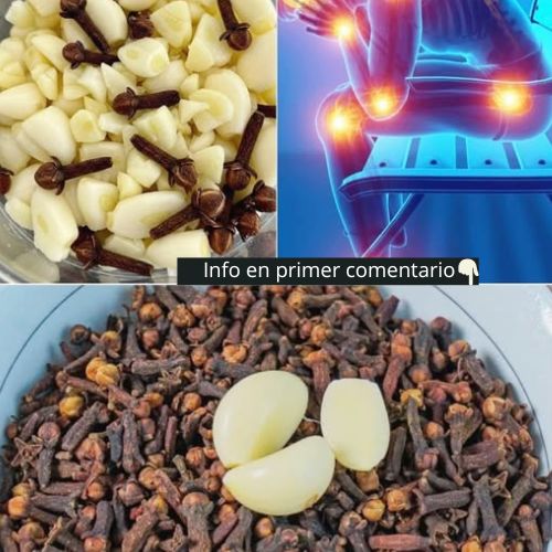 Remedios Naturales para Várices